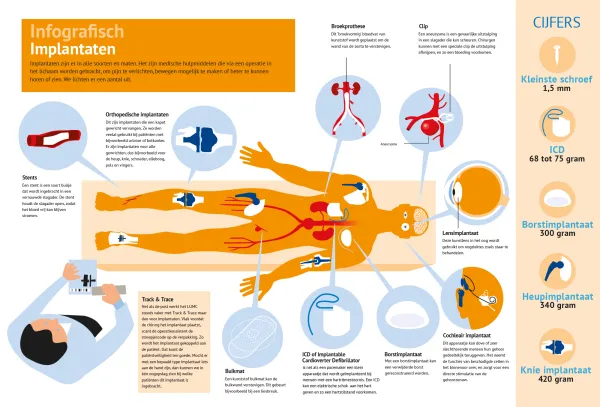 Implantaten